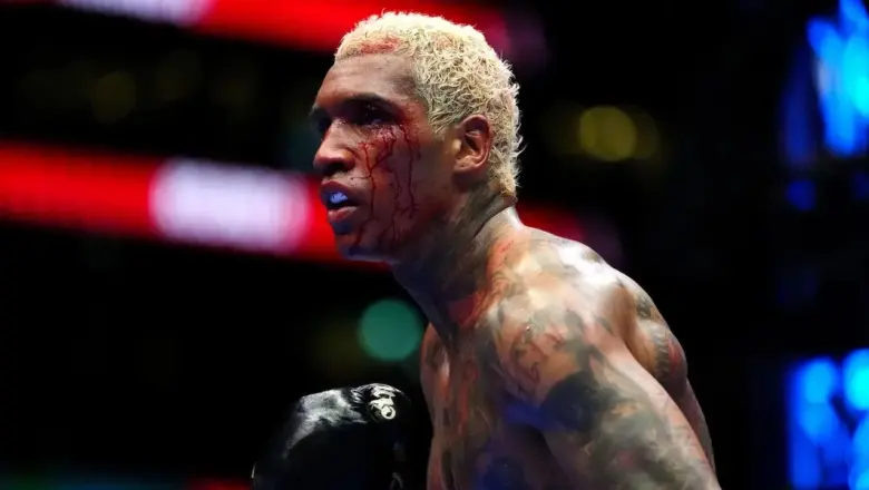 Conor Benn Diprediksi Bakal Tumbang Saat Hadapi Garcia