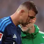 Kepalanya Bocor Saat Lawan Mainz, Edin Dzeko Berpeluang Absen Lawan Koln